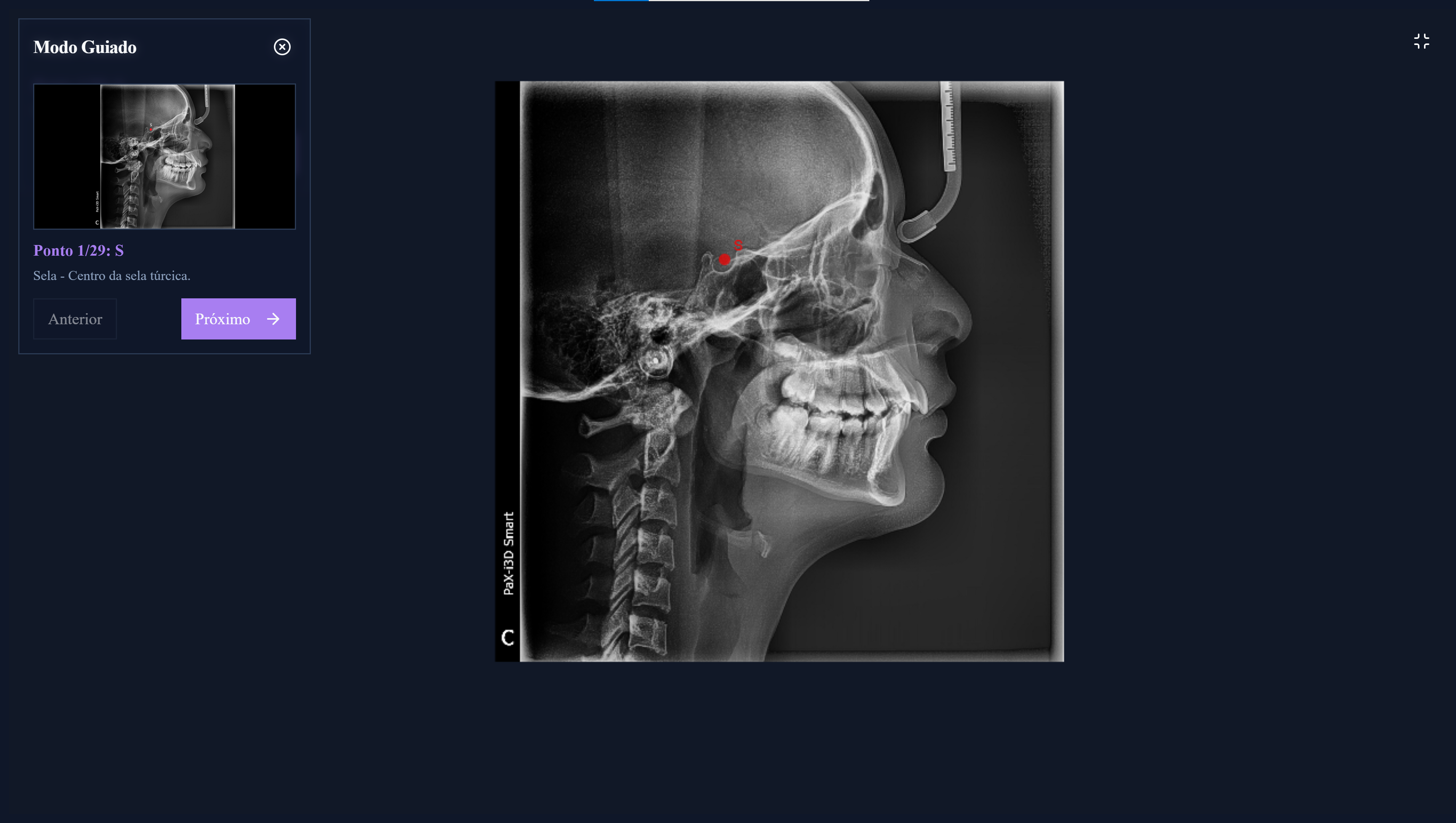 Análise Cefalométrica Manual